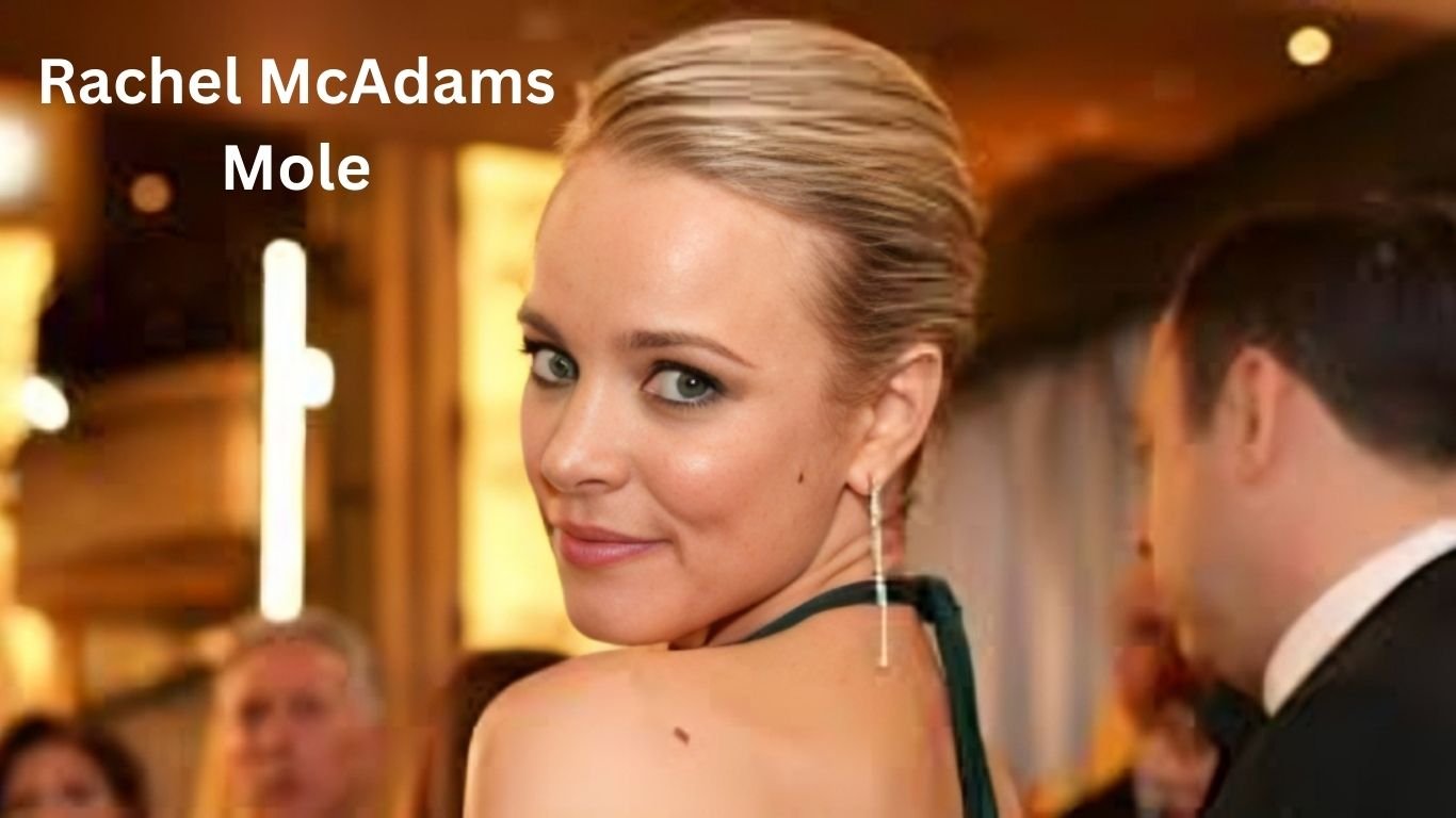 Rachel McAdams Mole